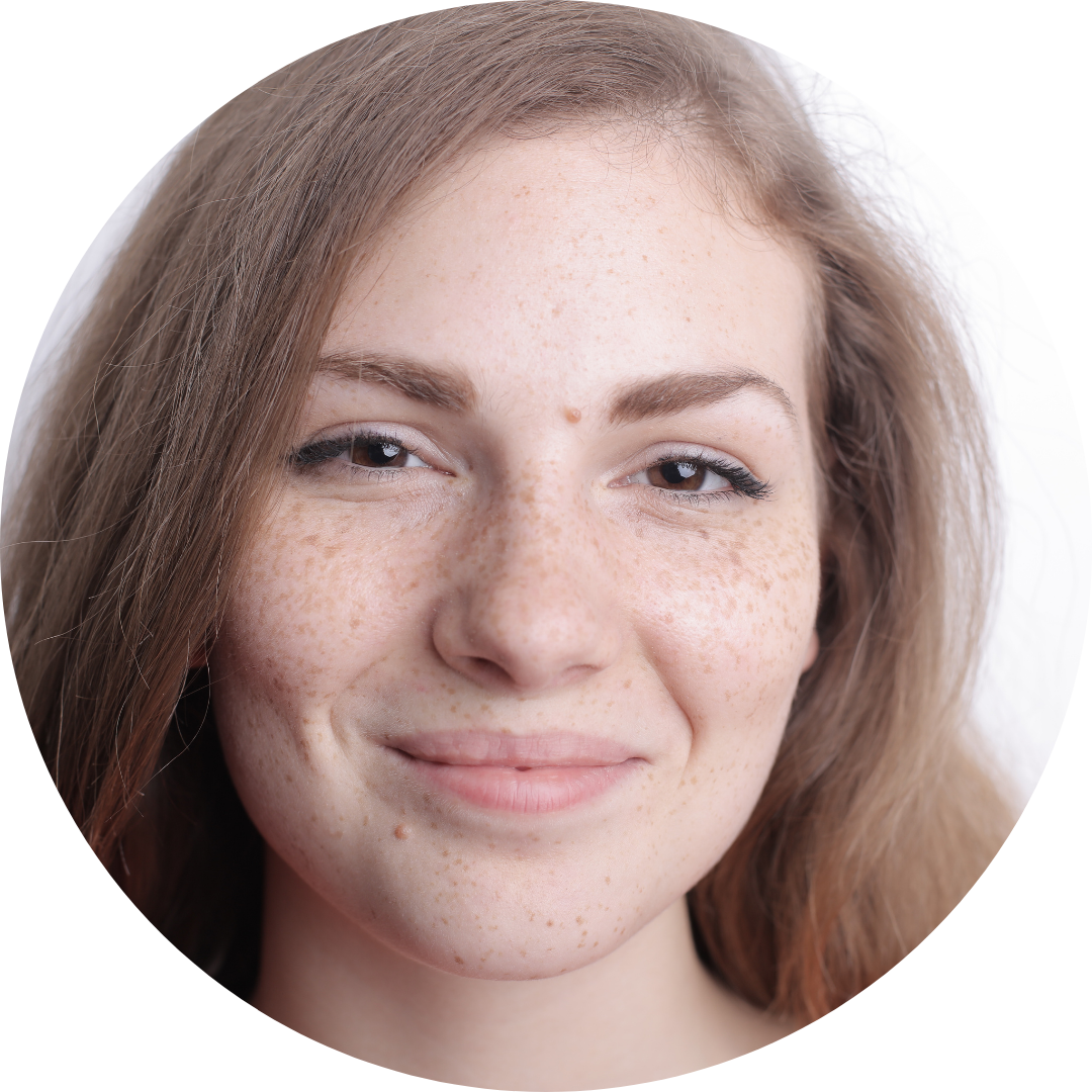 Young woman with IBS and hormone problems